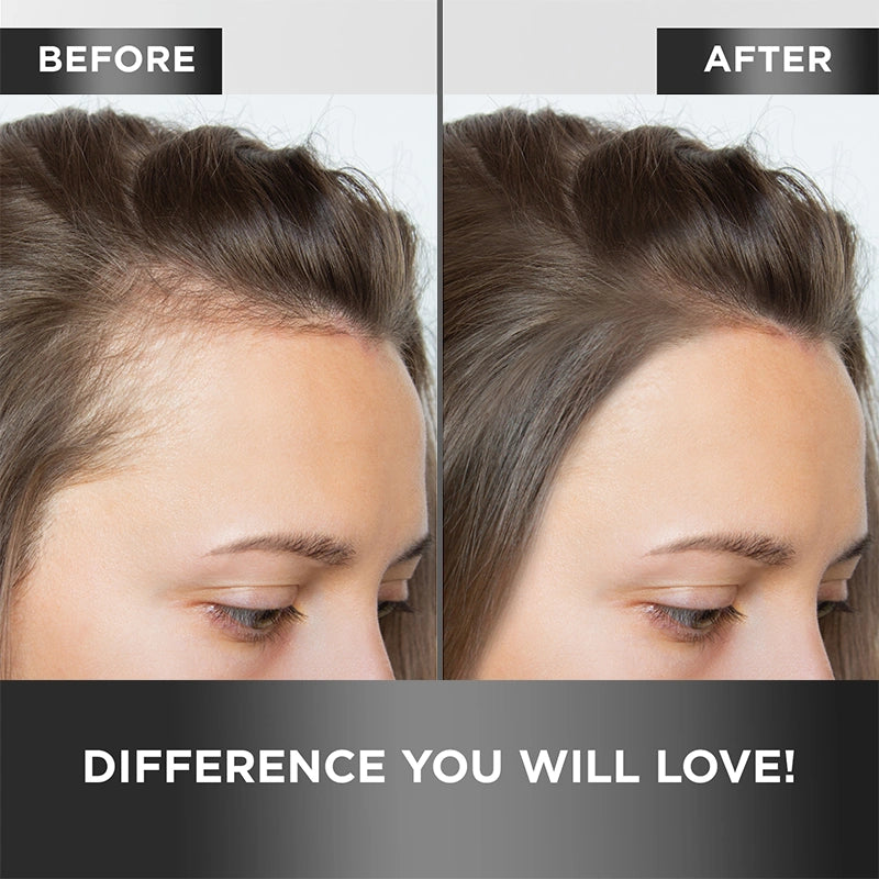Before and After Use - Hair Guard Tonic 
